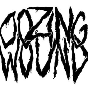Oozing Wound